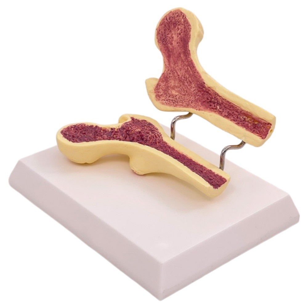 Medical Anatomical Human Femur Bone Model for School Teaching Display